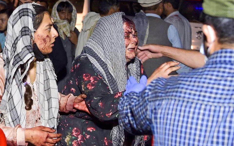 Afganistan’ın Başkenti Kabil’de Patlamalar Sonucunda Yaklaşık 90 Sivil İnsan Hayatını Kaybetti